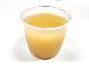 glass of cabbage juice benefits for digestion